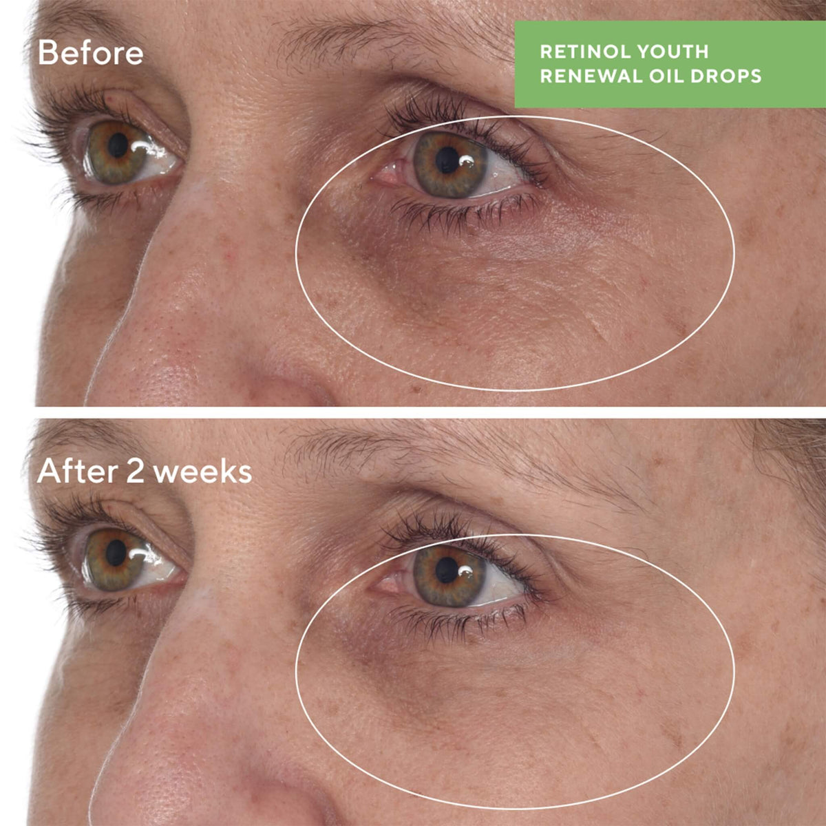 Retinol Youth Renewal Oil Drops, Resurgence, 30 ml.