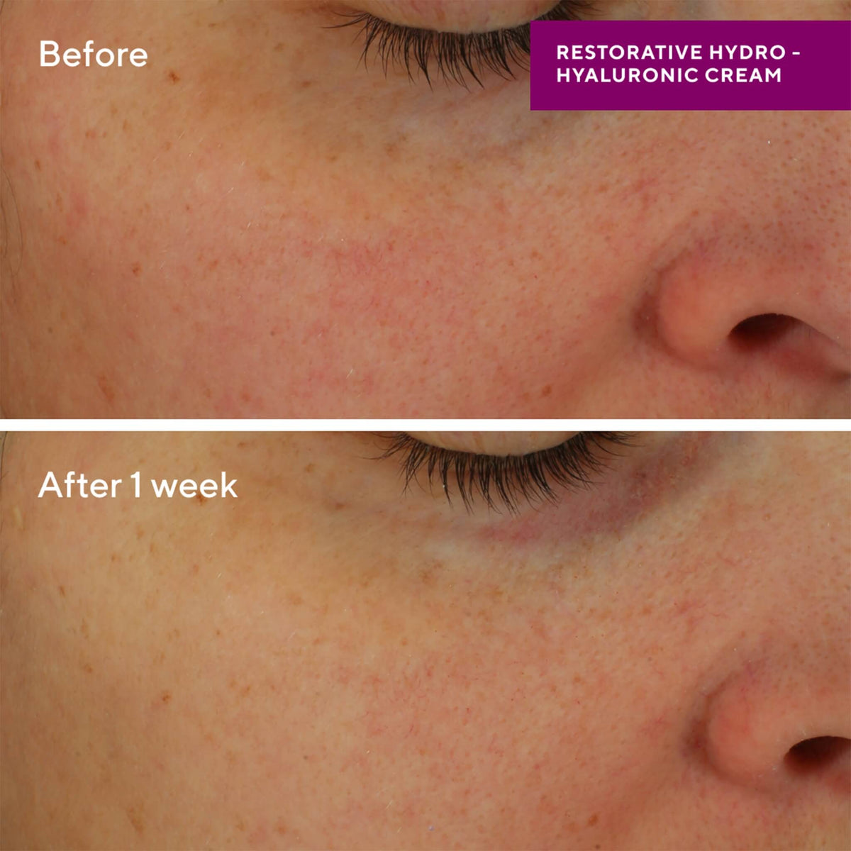 Restorative Hydro-Hyaluronic Cream, Hydration, 50 ml.