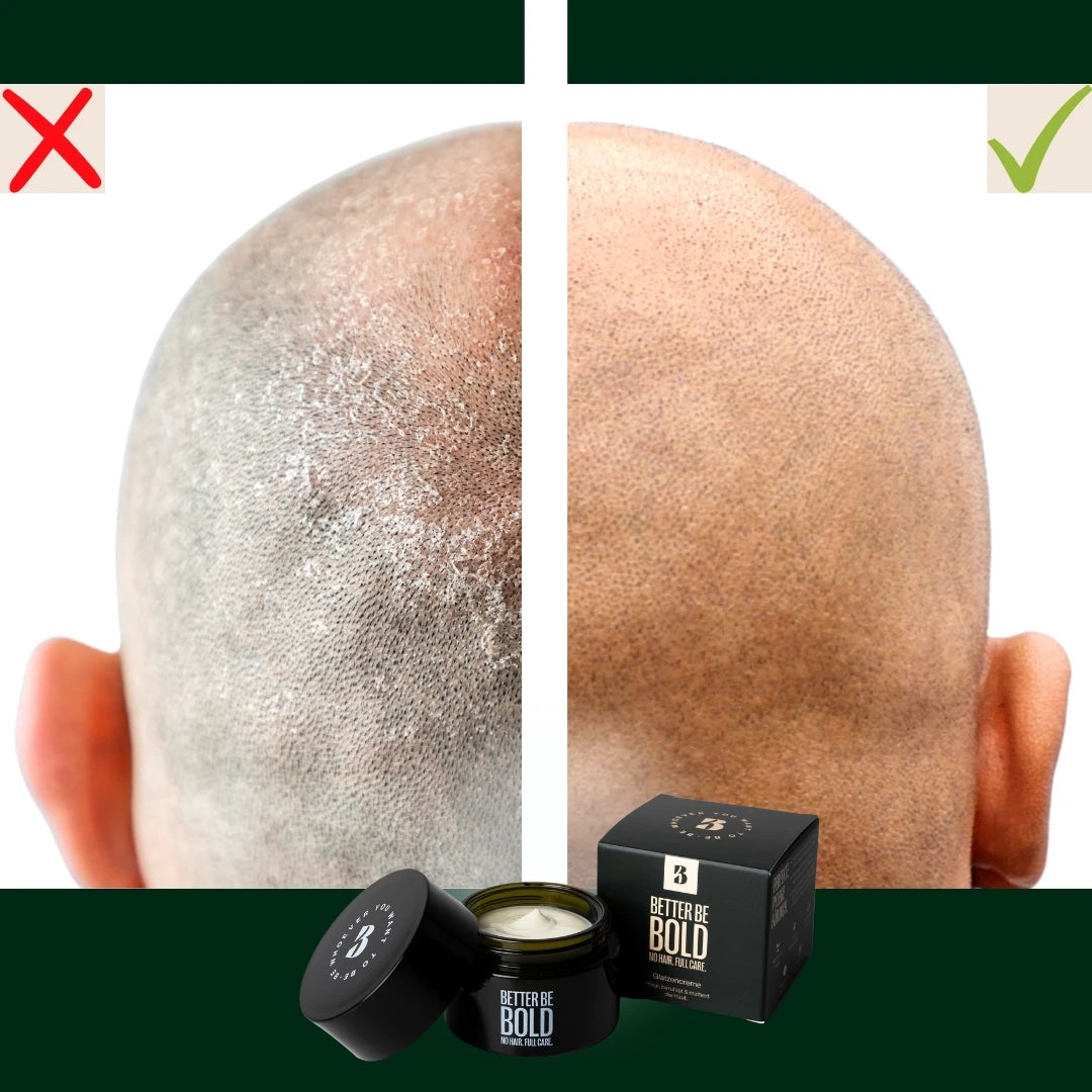 Moisturizing Bald Cream (0-3 mm.) - Matt Effect, 50 ml.
