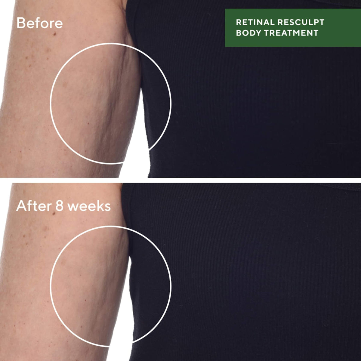 Retinal ReSculpt Body Treatment, Resurgence, 148 ml.