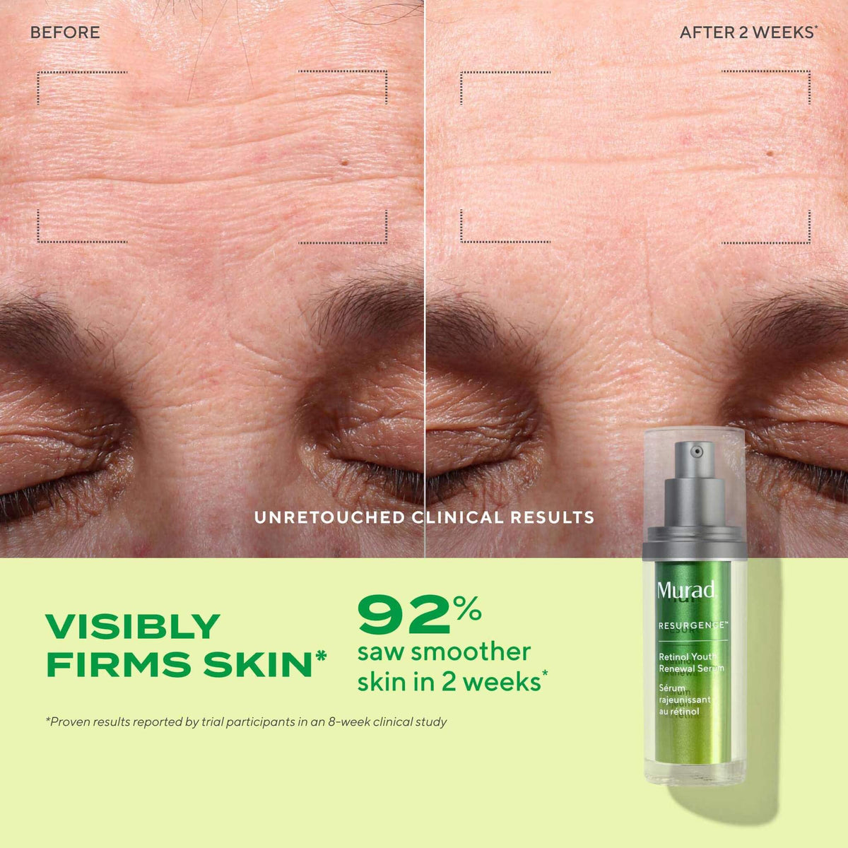 Retinol Youth Renewal Serum, Resurgence, 30 ml.